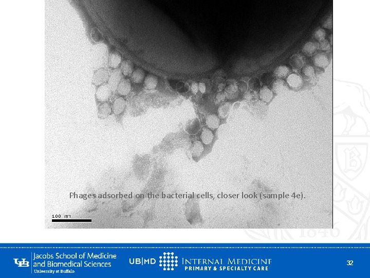 Phages adsorbed on the bacterial cells, closer look (sample 4 e). 32 