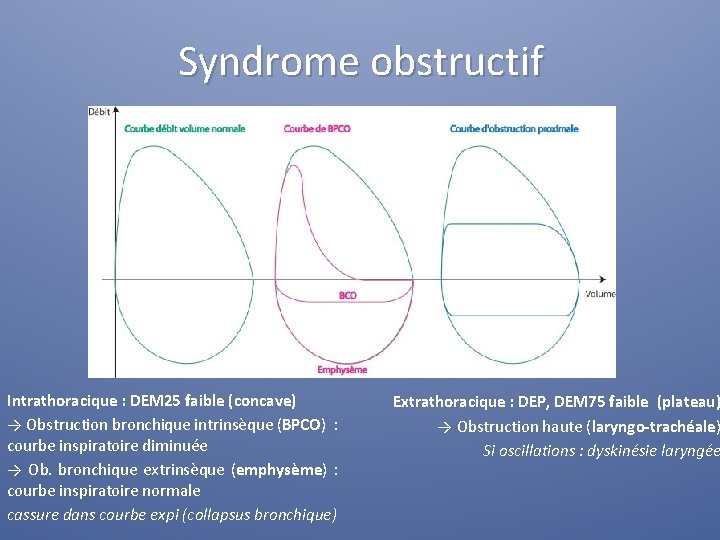 Syndrome obstructif Intrathoracique : DEM 25 faible (concave) → Obstruction bronchique intrinsèque (BPCO) :