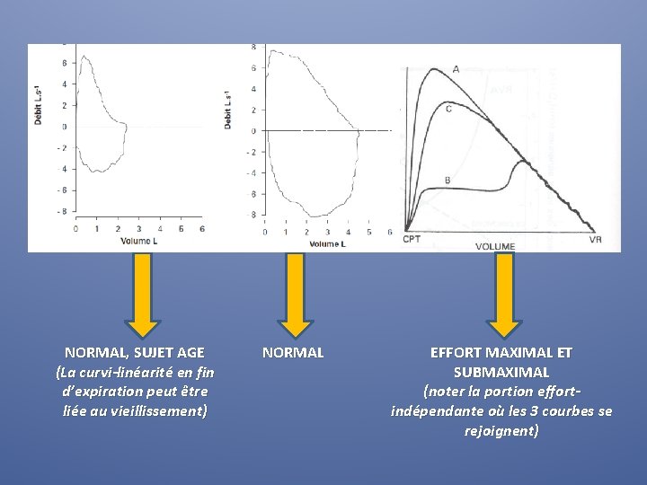 NORMAL, SUJET AGE (La curvi-linéarité en fin d’expiration peut être liée au vieillissement) NORMAL