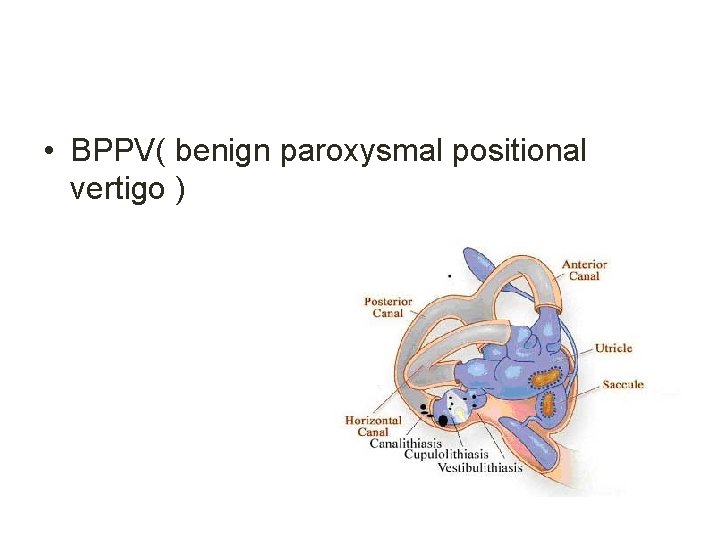  • BPPV( benign paroxysmal positional vertigo ) 