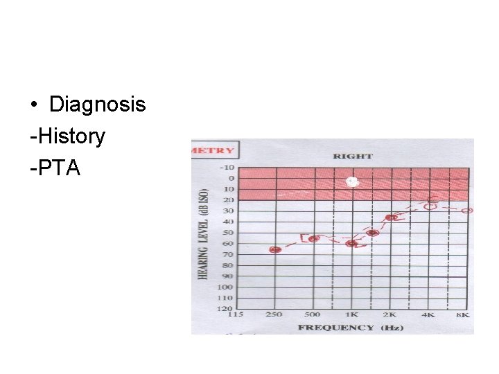  • Diagnosis -History -PTA 