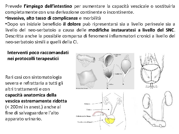 Prevede l’impiego dell’intestino per aumentare la capacità vescicale o sostituirla completamente con una derivazione