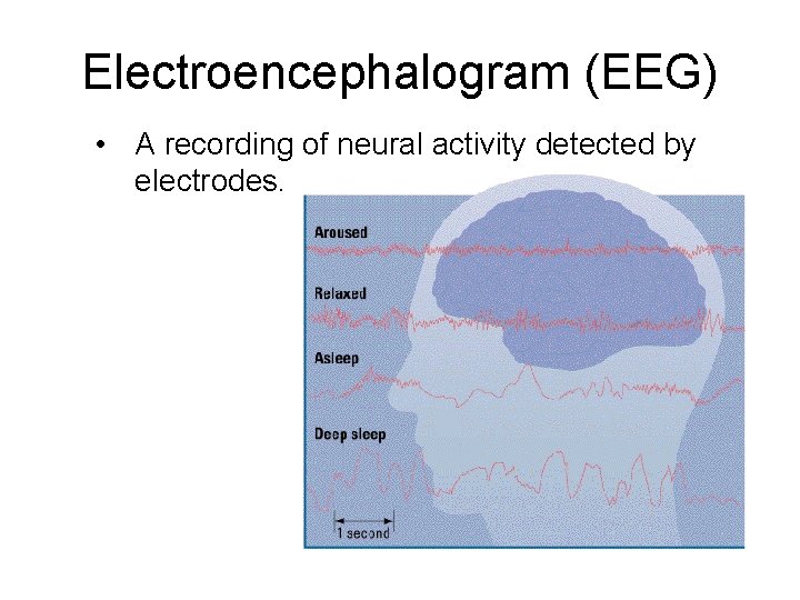 Electroencephalogram (EEG) • A recording of neural activity detected by electrodes. 