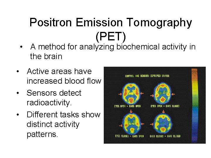 Positron Emission Tomography (PET) • A method for analyzing biochemical activity in the brain