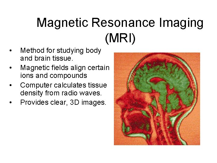 Magnetic Resonance Imaging (MRI) • • Method for studying body and brain tissue. Magnetic