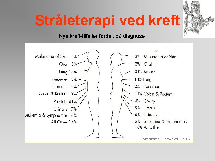 Stråleterapi ved kreft Nye kreft-tilfeller fordelt på diagnose Washington & Leaver vol. 1, 1996