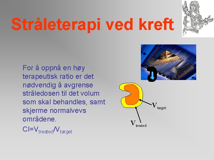 Stråleterapi ved kreft For å oppnå en høy terapeutisk ratio er det nødvendig å