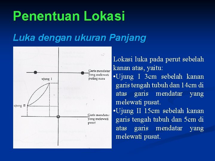 Penentuan Lokasi Luka dengan ukuran Panjang Lokasi luka pada perut sebelah kanan atas, yaitu: Penentuan Lokasi Luka dengan ukuran Panjang Lokasi luka pada perut sebelah kanan atas, yaitu: