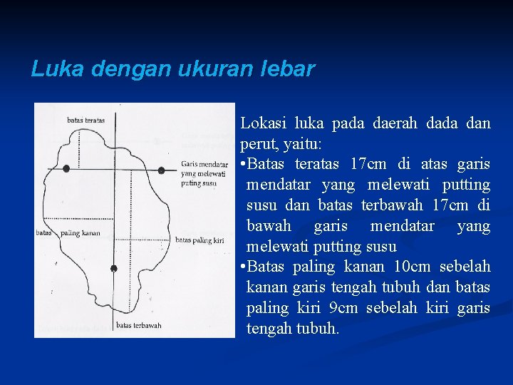 Luka dengan ukuran lebar Lokasi luka pada daerah dada dan perut, yaitu: • Batas Luka dengan ukuran lebar Lokasi luka pada daerah dada dan perut, yaitu: • Batas