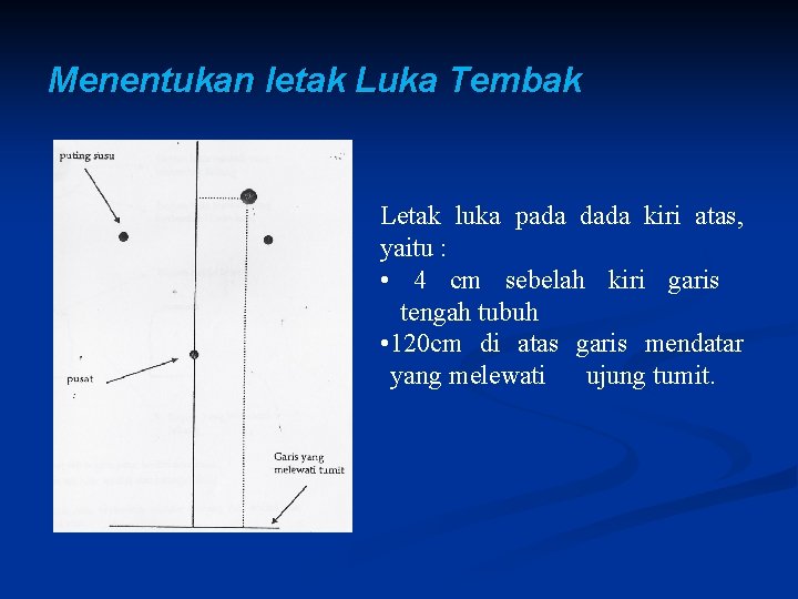 Menentukan letak Luka Tembak Letak luka pada dada kiri atas, yaitu : • 4 Menentukan letak Luka Tembak Letak luka pada dada kiri atas, yaitu : • 4