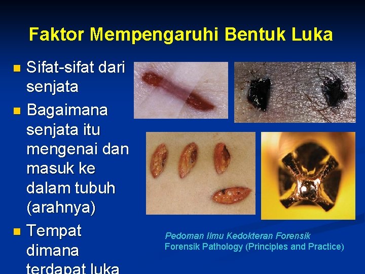 Faktor Mempengaruhi Bentuk Luka Sifat-sifat dari senjata n Bagaimana senjata itu mengenai dan masuk Faktor Mempengaruhi Bentuk Luka Sifat-sifat dari senjata n Bagaimana senjata itu mengenai dan masuk