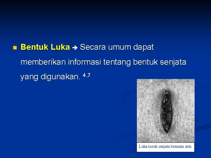 n Bentuk Luka Secara umum dapat memberikan informasi tentang bentuk senjata yang digunakan. 4, n Bentuk Luka Secara umum dapat memberikan informasi tentang bentuk senjata yang digunakan. 4,