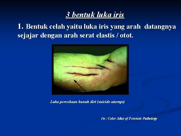 3 bentuk luka iris 1. Bentuk celah yaitu luka iris yang arah datangnya sejajar 3 bentuk luka iris 1. Bentuk celah yaitu luka iris yang arah datangnya sejajar