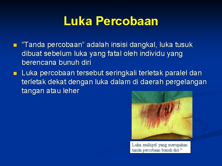 Luka Percobaan n n ”Tanda percobaan” adalah insisi dangkal, luka tusuk dibuat sebelum luka Luka Percobaan n n ”Tanda percobaan” adalah insisi dangkal, luka tusuk dibuat sebelum luka