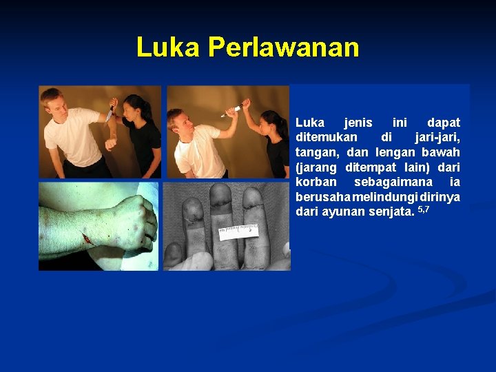 Luka Perlawanan Luka jenis ini dapat ditemukan di jari-jari, tangan, dan lengan bawah (jarang Luka Perlawanan Luka jenis ini dapat ditemukan di jari-jari, tangan, dan lengan bawah (jarang