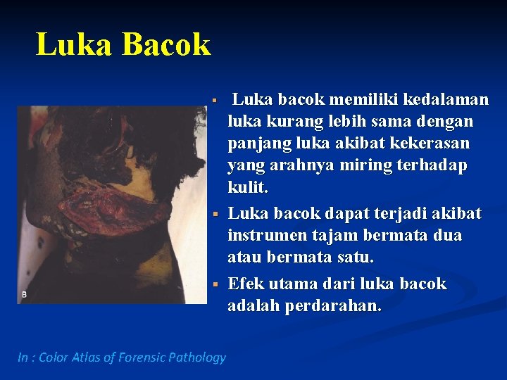 Luka Bacok § Luka bacok memiliki kedalaman § luka kurang lebih sama dengan panjang Luka Bacok § Luka bacok memiliki kedalaman § luka kurang lebih sama dengan panjang