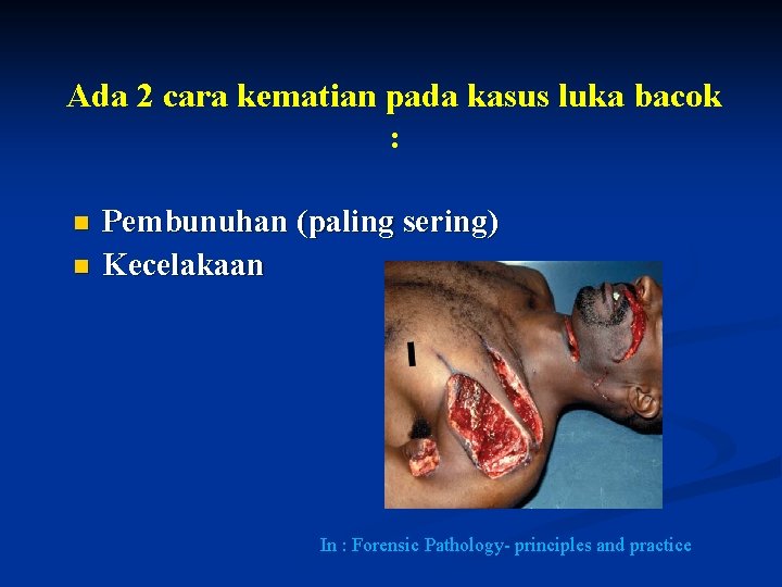 Ada 2 cara kematian pada kasus luka bacok : n n Pembunuhan (paling sering) Ada 2 cara kematian pada kasus luka bacok : n n Pembunuhan (paling sering)