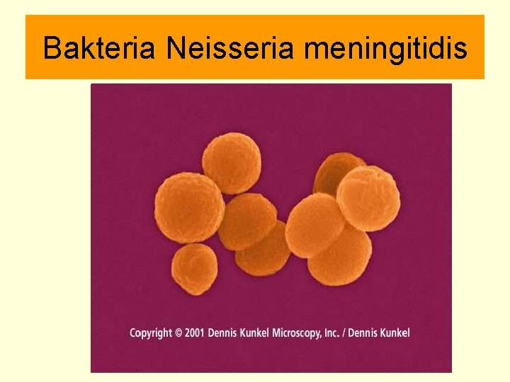 Bakteria Neisseria meningitidis 