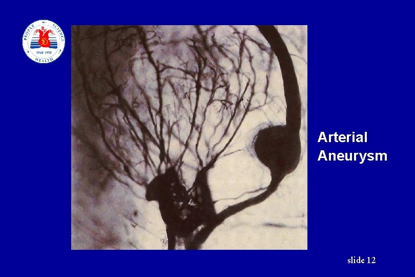 Arterial Aneurysm slide 12 