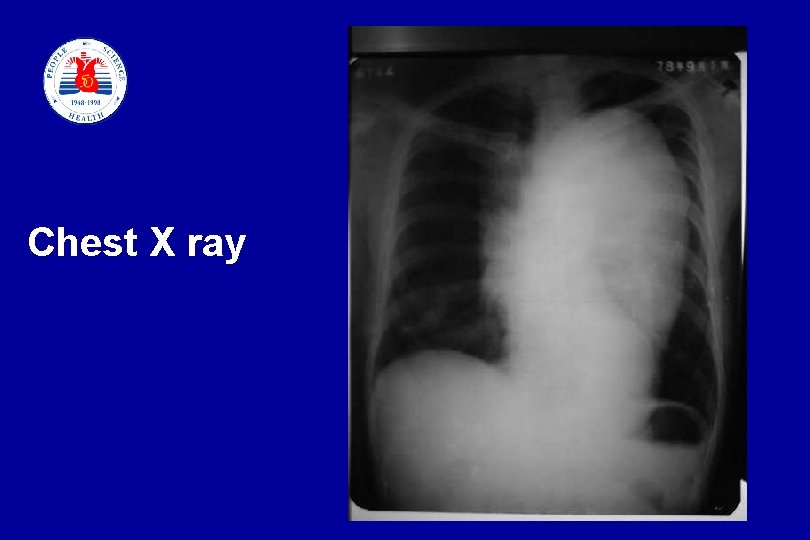 Chest X ray slide 76 