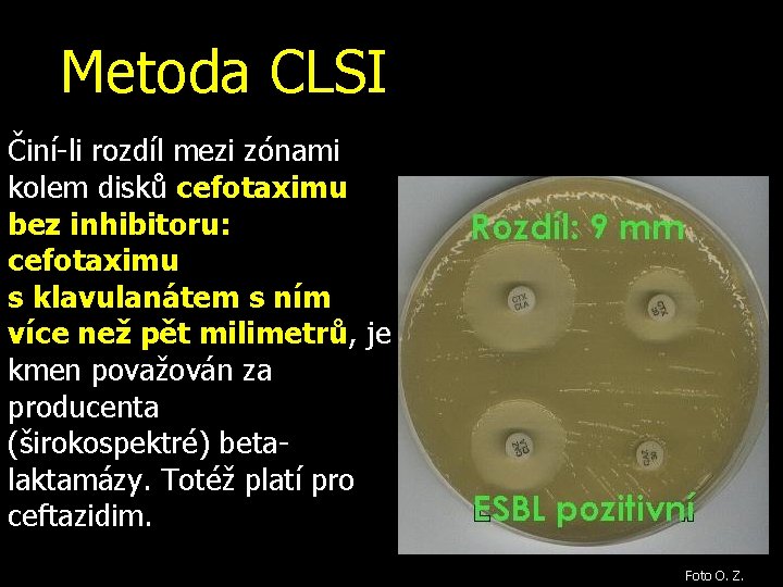 Metoda CLSI Činí-li rozdíl mezi zónami kolem disků cefotaximu bez inhibitoru: cefotaximu s klavulanátem