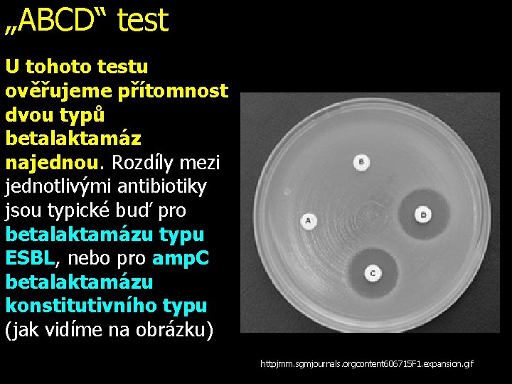 „ABCD“ test U tohoto testu ověřujeme přítomnost dvou typů betalaktamáz najednou. Rozdíly mezi jednotlivými