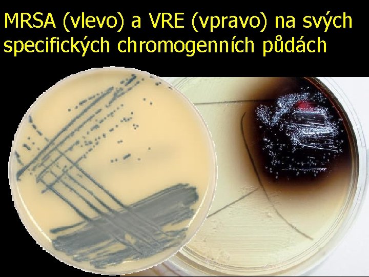 MRSA (vlevo) a VRE (vpravo) na svých specifických chromogenních půdách 