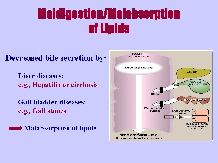 Maldigestion/Malabsorption of Lipids Decreased bile secretion by: Liver diseases: e. g. , Hepatitis or