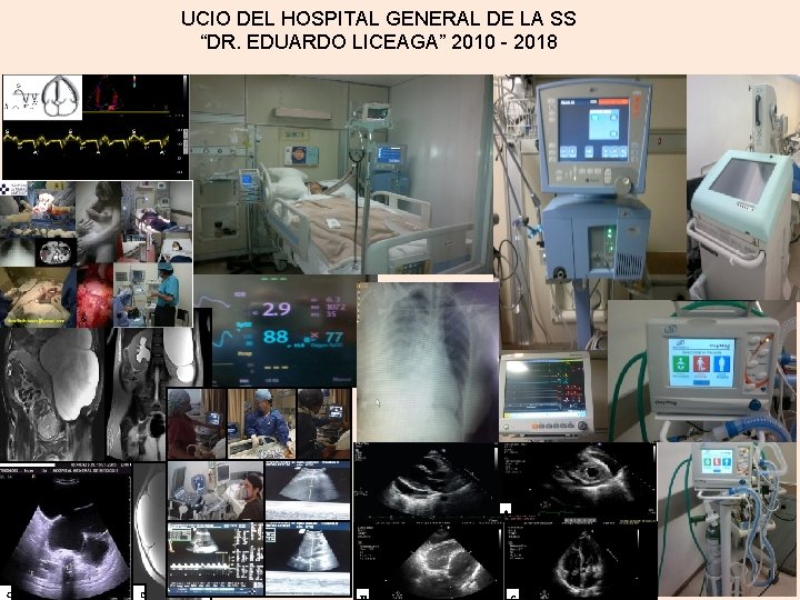 UCIO DEL HOSPITAL GENERAL DE LA SS “DR. EDUARDO LICEAGA” 2010 - 2018 A