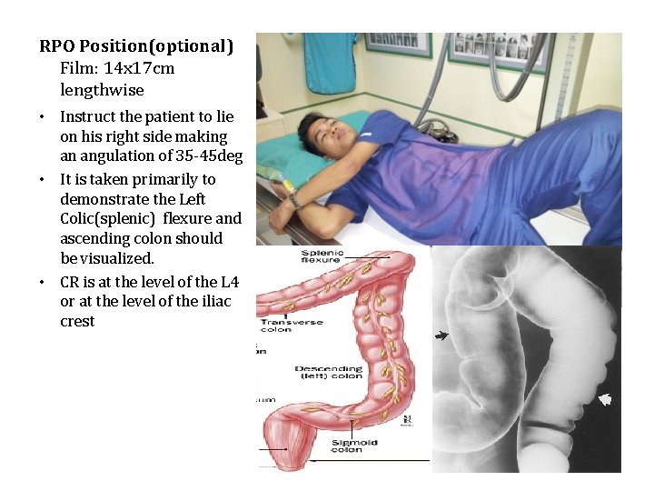 RPO Position(optional) Film: 14 x 17 cm lengthwise • Instruct the patient to lie