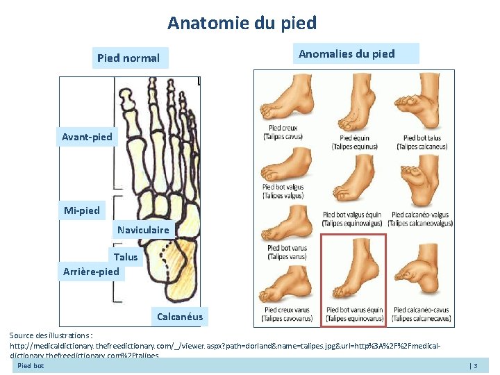 Anatomie du pied Pied normal Anomalies du pied Avant-pied Mi-pied Naviculaire Talus Arrière-pied Calcanéus
