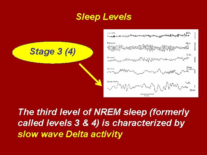 Sleep Levels Stage 3 (4) The third level of NREM sleep (formerly called levels