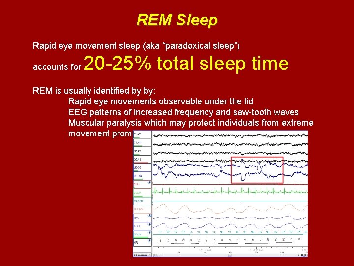 REM Sleep Rapid eye movement sleep (aka “paradoxical sleep”) accounts for 20 -25% total