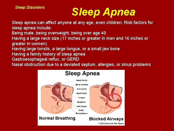 Sleep Disorders Sleep Apnea Sleep apnea can affect anyone at any age, even children.