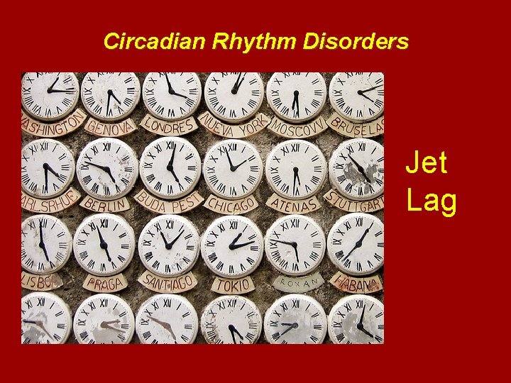 Circadian Rhythm Disorders Jet Lag 