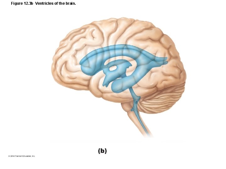 Figure 12. 3 b Ventricles of the brain. 