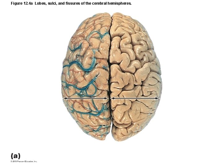 Figure 12. 4 a Lobes, sulci, and fissures of the cerebral hemispheres. 