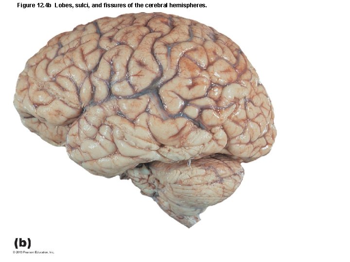 Figure 12. 4 b Lobes, sulci, and fissures of the cerebral hemispheres. 