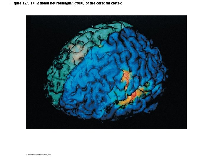 Figure 12. 5 Functional neuroimaging (f. MRI) of the cerebral cortex. 