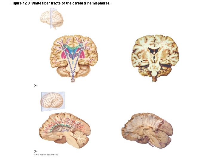 Figure 12. 8 White fiber tracts of the cerebral hemispheres. 