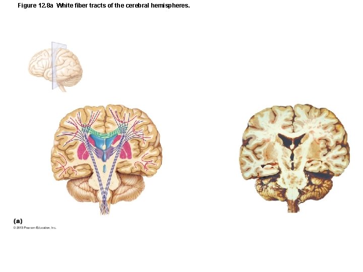 Figure 12. 8 a White fiber tracts of the cerebral hemispheres. 