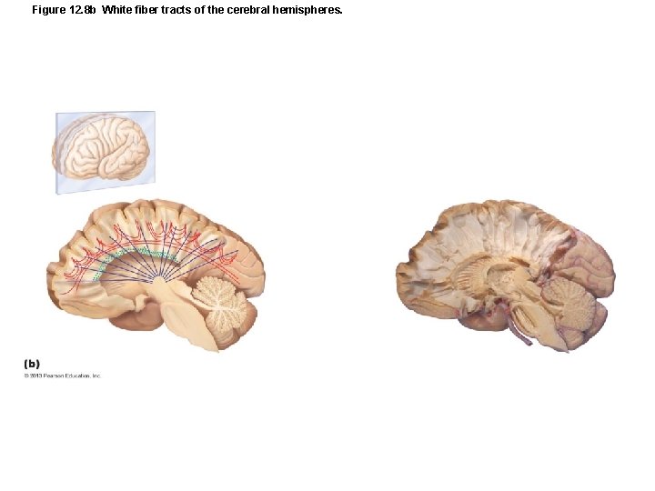 Figure 12. 8 b White fiber tracts of the cerebral hemispheres. 