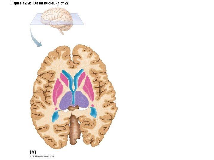 Figure 12. 9 b Basal nuclei. (1 of 2) 