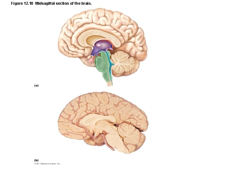 Figure 12. 10 Midsagittal section of the brain. 