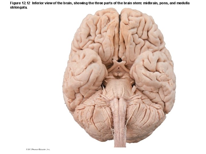 Figure 12. 12 Inferior view of the brain, showing the three parts of the