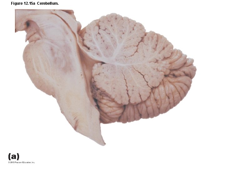 Figure 12. 15 a Cerebellum. 