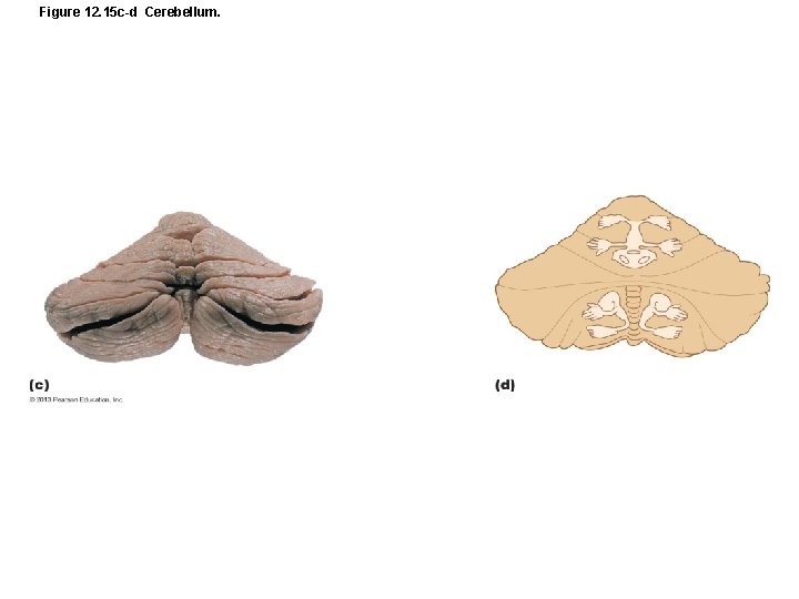 Figure 12. 15 c-d Cerebellum. 