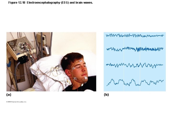 Figure 12. 18 Electroencephalography (EEG) and brain waves. 