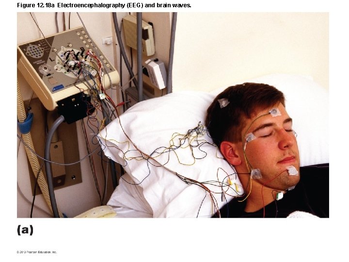 Figure 12. 18 a Electroencephalography (EEG) and brain waves. 