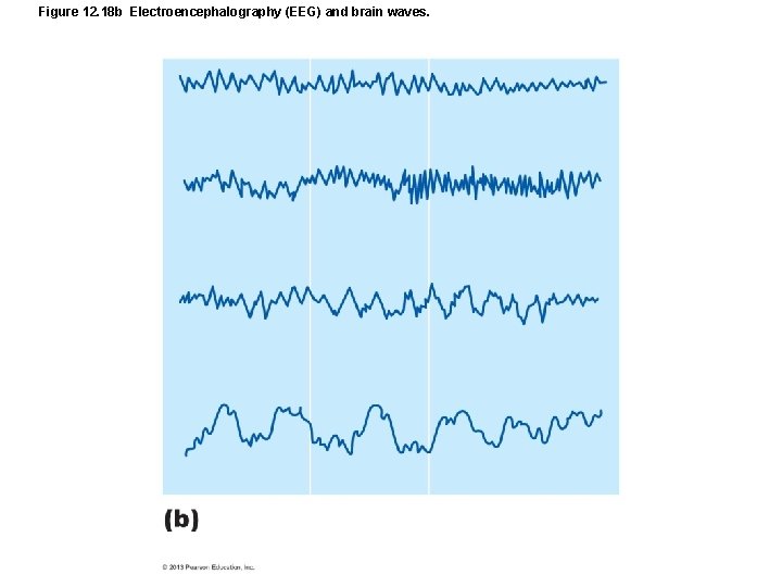 Figure 12. 18 b Electroencephalography (EEG) and brain waves. 